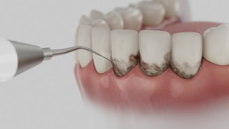 Trusted Dental Implants service in Frankfort, OH - Dentist Open Now